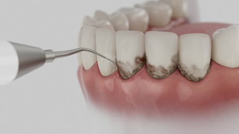 Reliable Emergency Dentist contractor in Ashburn, GA by Smile Center Dentistry